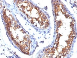 Mouse anti-CD99, Clone: HO36-1.1, Novus Biologicals 0.2mg; Unlabeled:Antibodies,